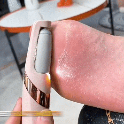 Flawless Pedi Rechargeable Tool File and Callus Remover Pedicure – Hypd.pk